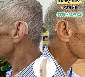 KHI NÀO CẦN DÙNG MÁY TRỢ THÍNH?