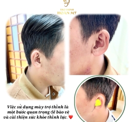 Vi sao phải sự dụng máy trợ thính 