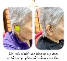 Đeo máy trợ thính có thể ngăn chặn sự suy giảm về khả năng nghe và hiểu lời nói của bạn